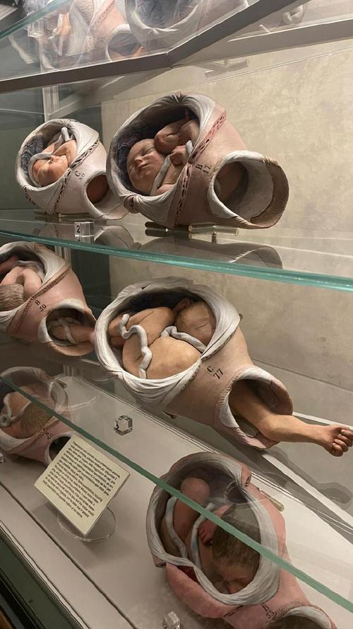 胚胎搞错