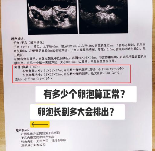 卵泡排出