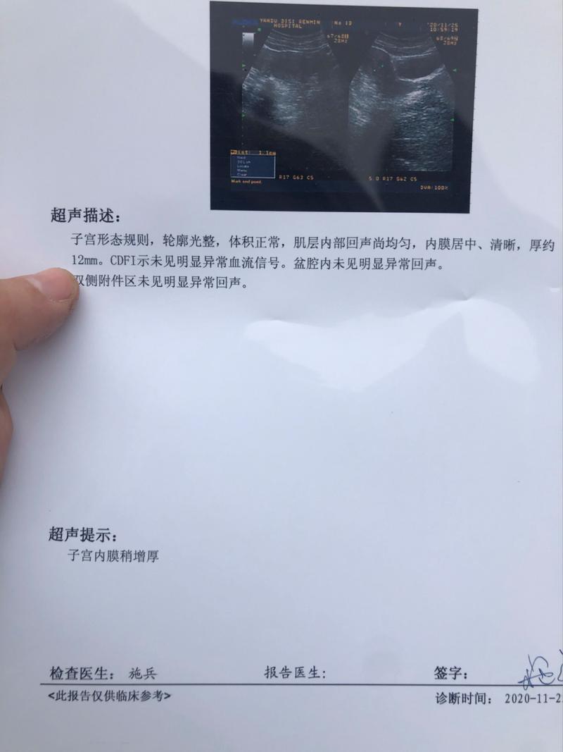  子宫内膜检查