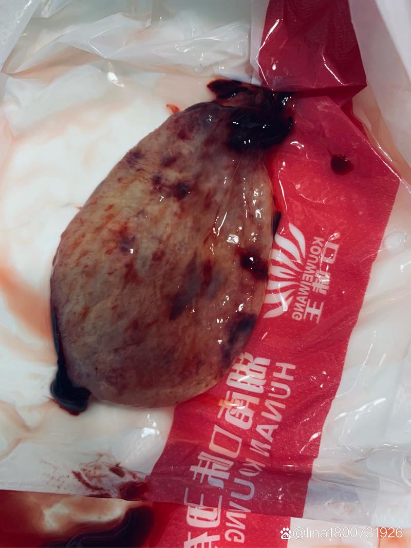 胚胎掉出