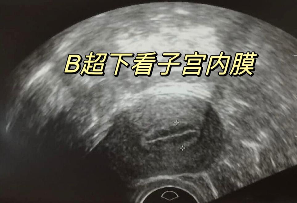 试管婴儿内膜厚度7.4是否适合成功怀孕？
