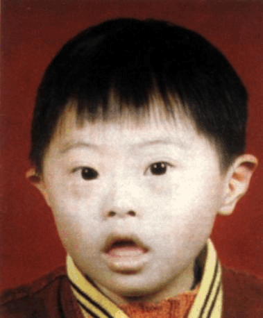 唐氏儿