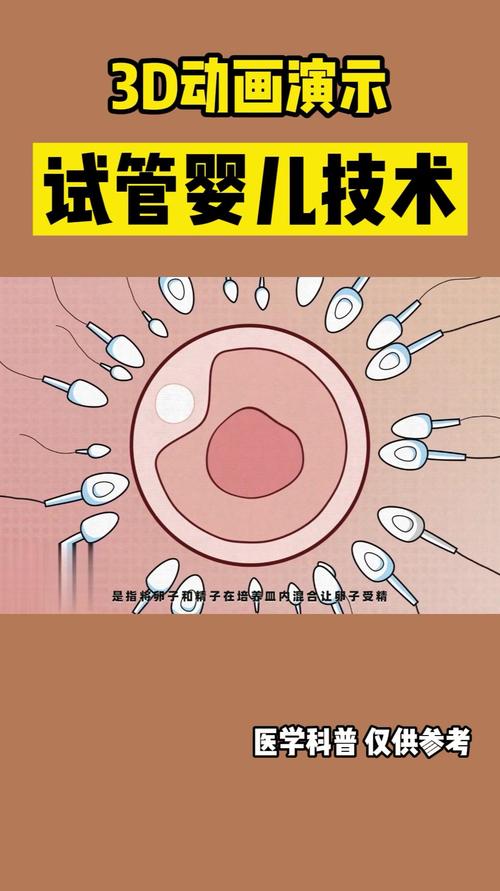 3D试管婴儿移植技术
