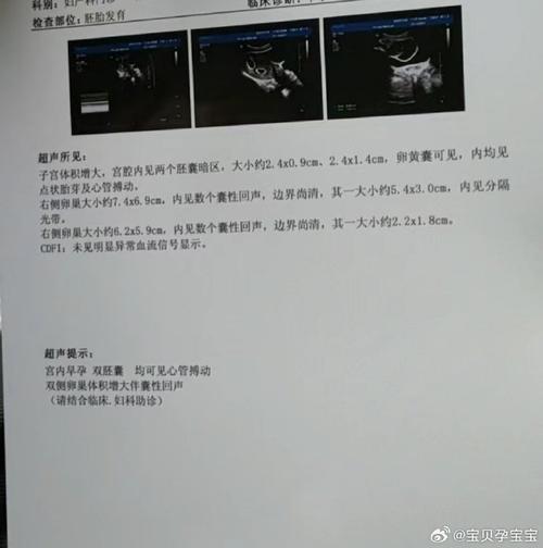 试管婴儿未成功怀孕