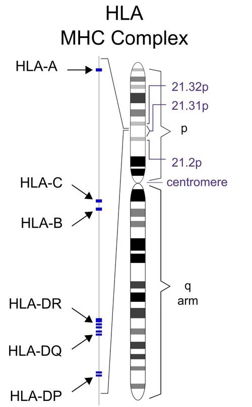 HLA