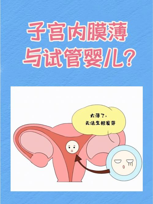内膜薄能否成功进行试管婴儿胚胎植入？