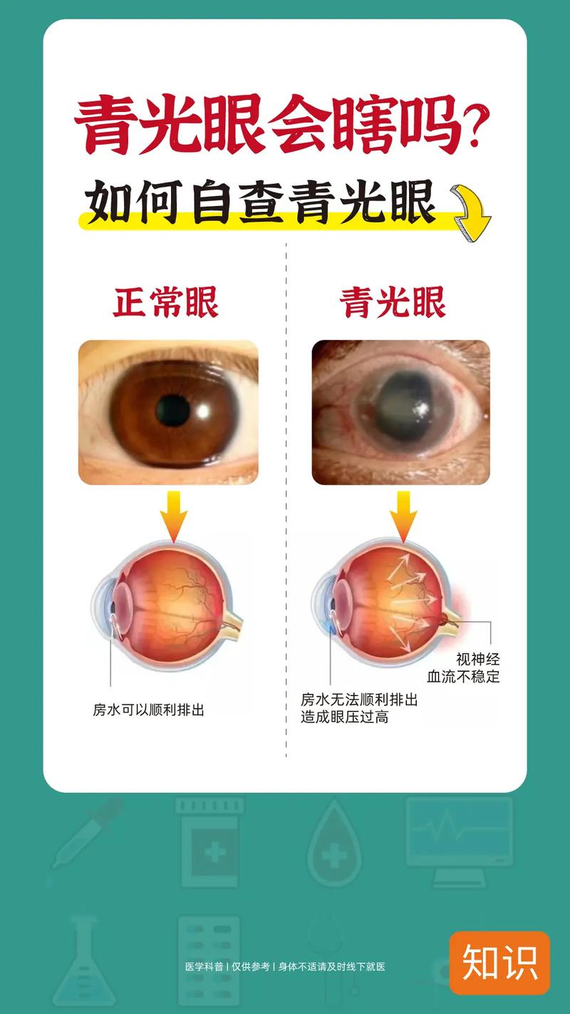 青光眼