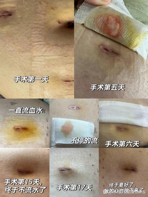 手术痛感