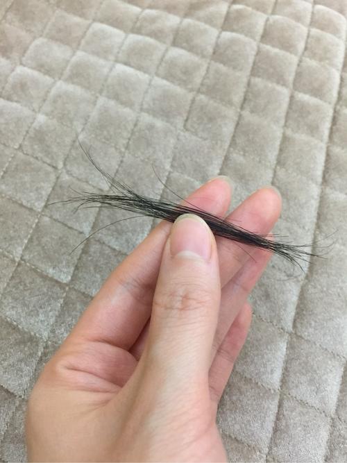 促排期间掉发