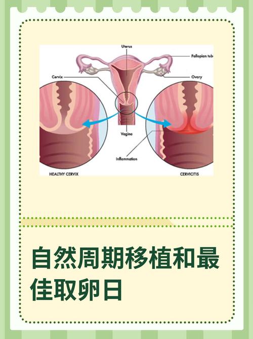 取卵周期
