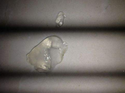 死精症