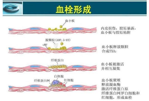 内膜粘附