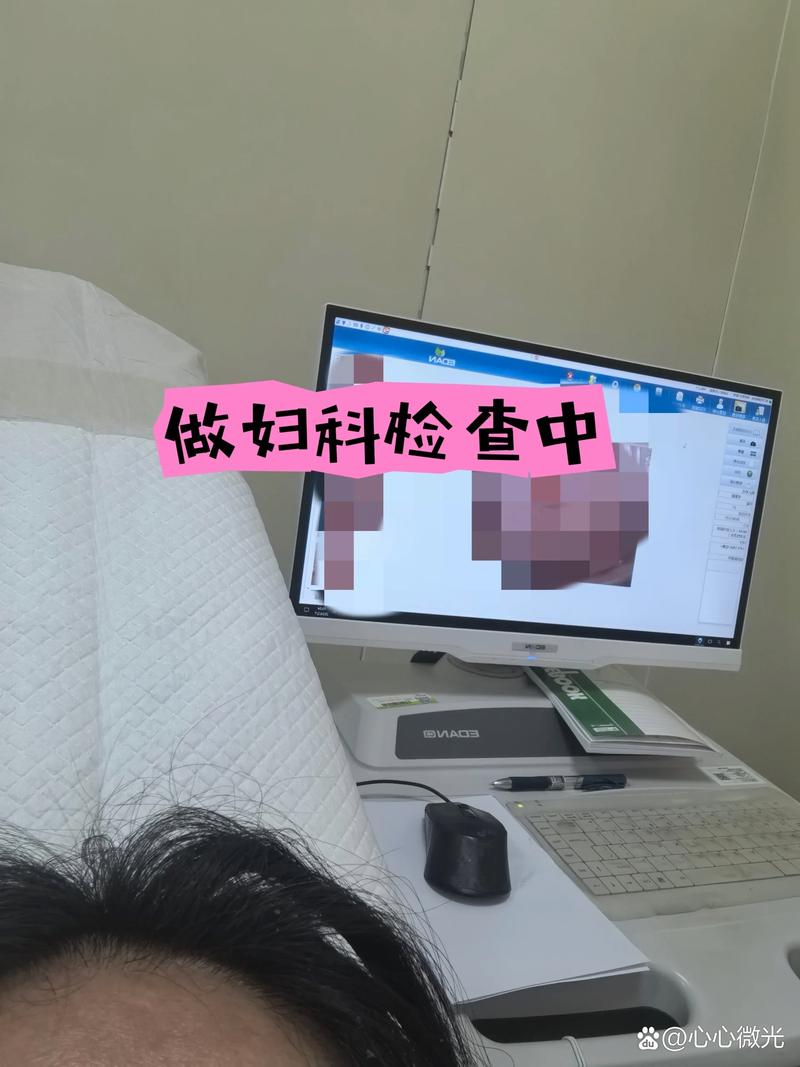 昆明产检