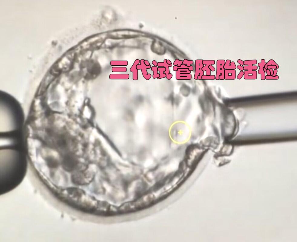 试管婴儿、胚胎活检、生殖医学