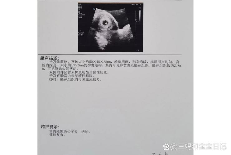 移植第25天