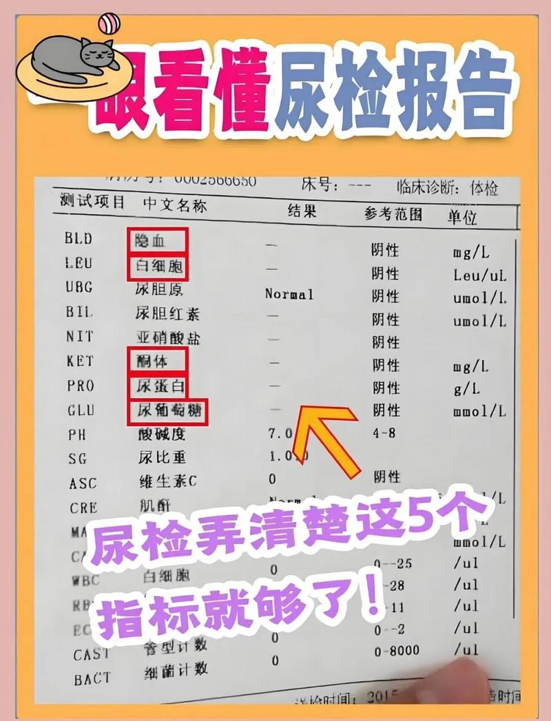 尿液检查