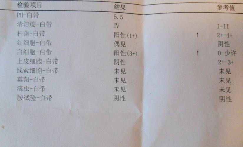 分泌物检测