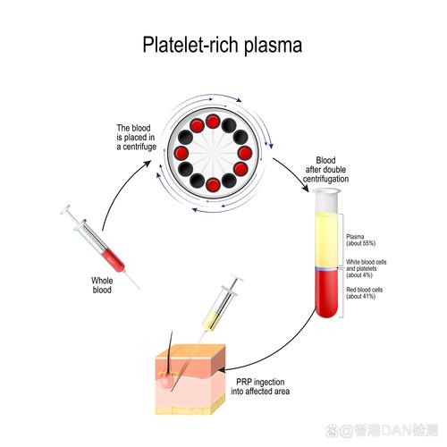 RSMC试管技术