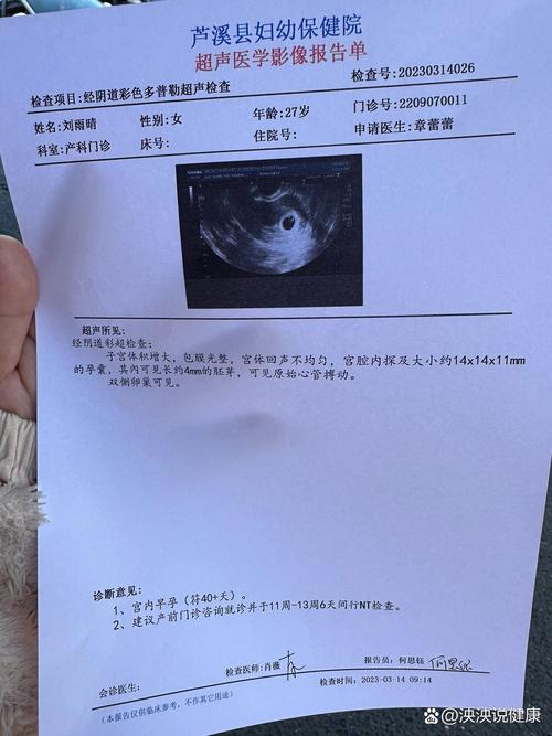 阴超检查