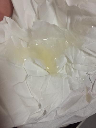精子采集