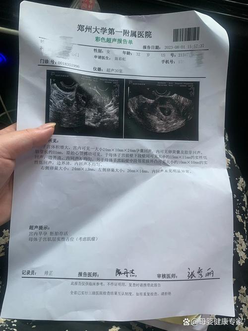 移植35天