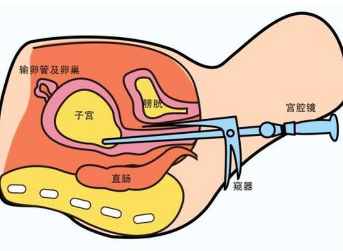 移植最佳位置