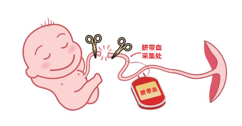 脐带血