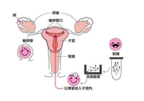 人工授精

您好