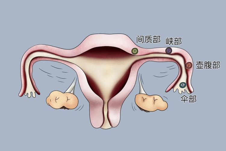 输卵管妊娠