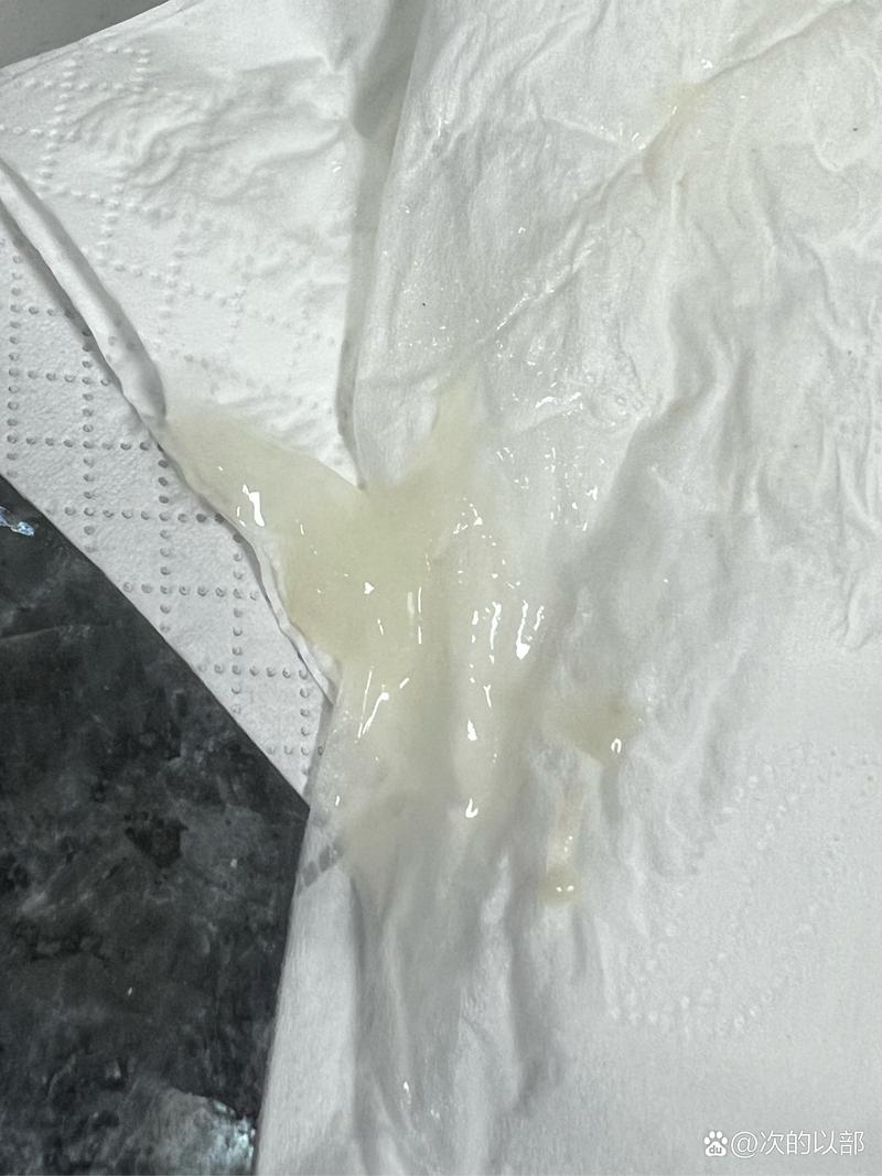 白带颜色