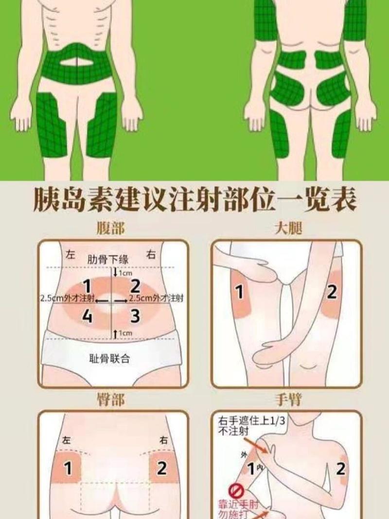 注射位置