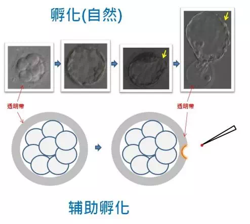 】：辅助孵化技术