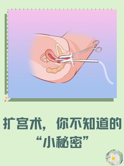 子宫扩张