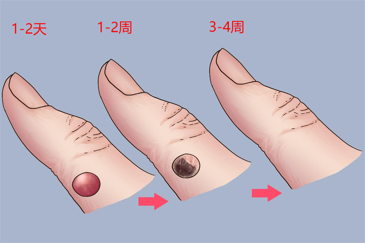冷冻过程
