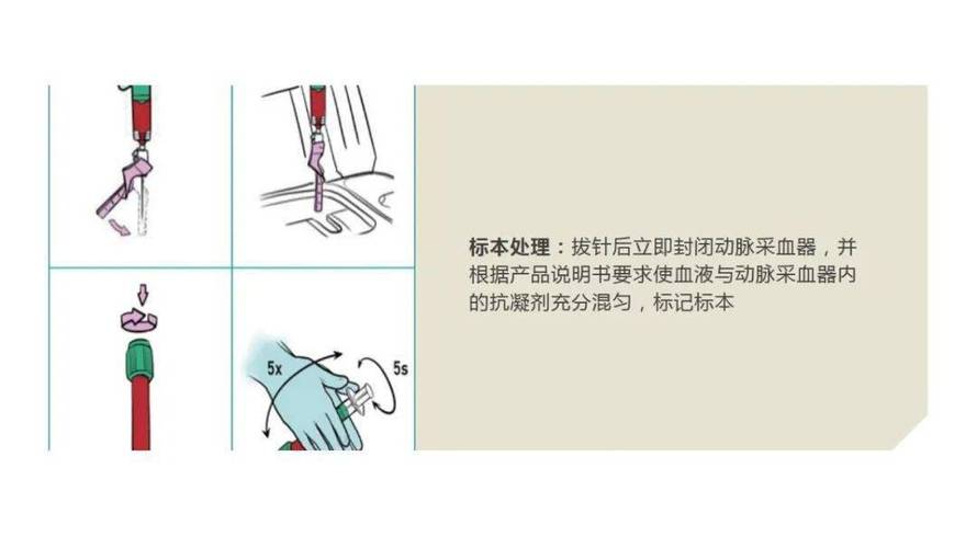  手术采集法