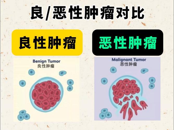 恶性病变