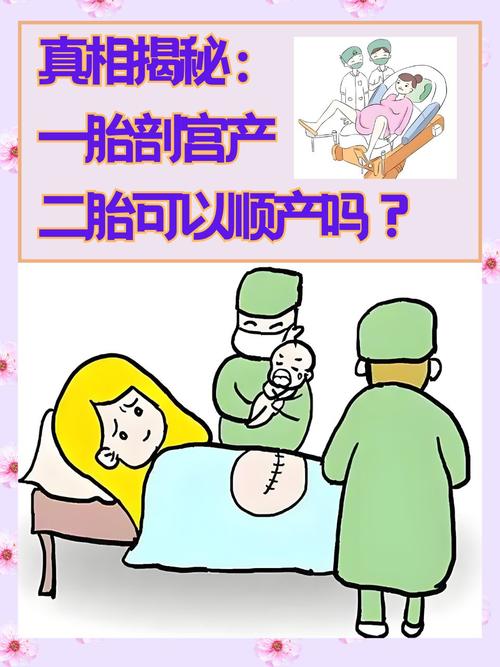 孕育选择