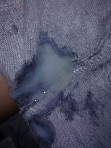 男方精液