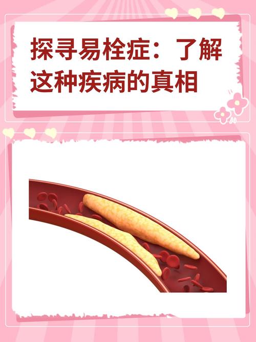 易栓倾向