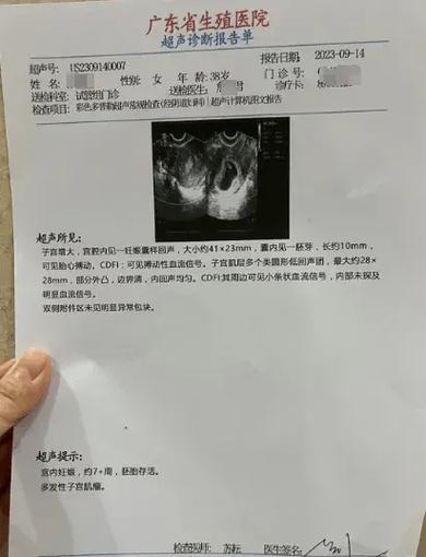 移植检查报告