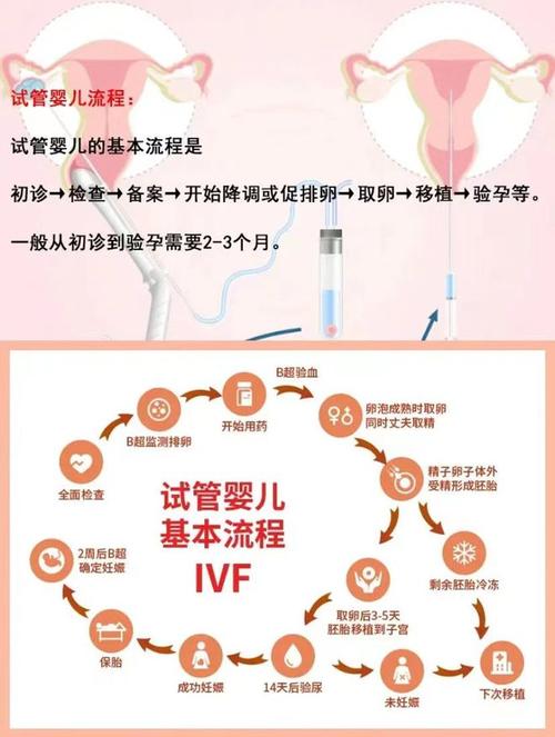 试管婴儿视频指南