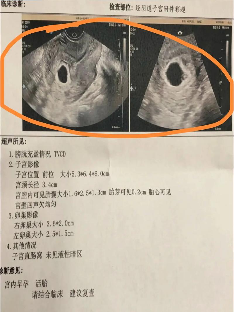 胚胎结果图片