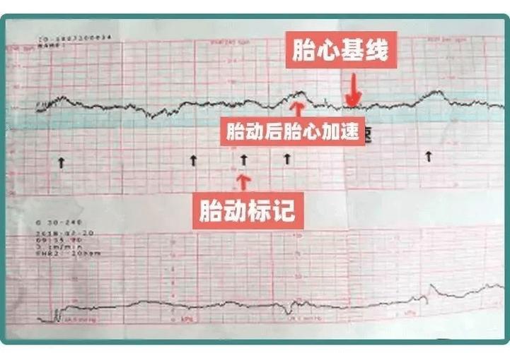 生殖医疗
描述: 本文详细阐述了试管婴儿胎心85每次监测的意义，如作为宝宝健康的“晴雨表”、帮助调整治疗方案等。还讲述了可能带来的心理、医疗等方面影响，提醒准父母重视并积极应对。