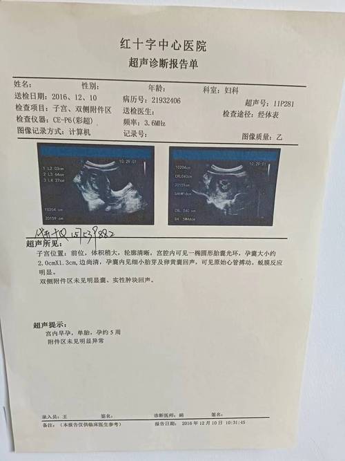 B超图片