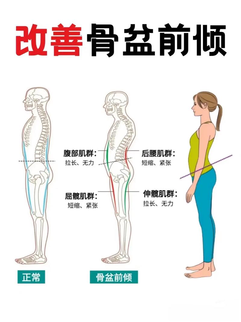 前倾位
