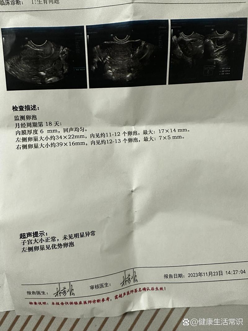 卵泡变小