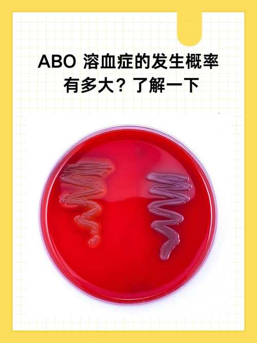 ABO溶血