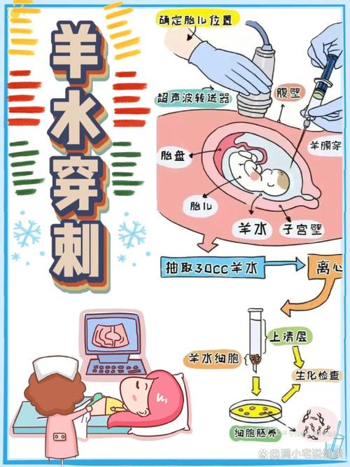 羊穿