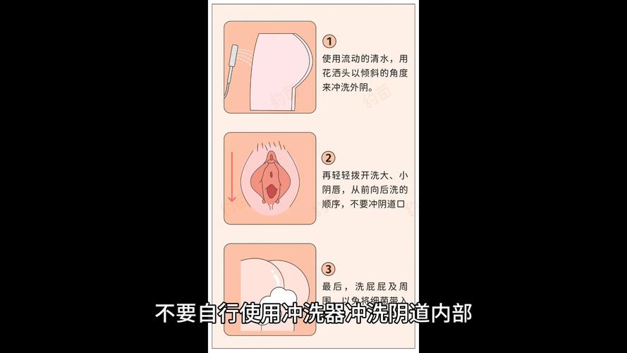 事后清洁