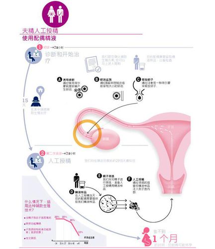 生殖助孕